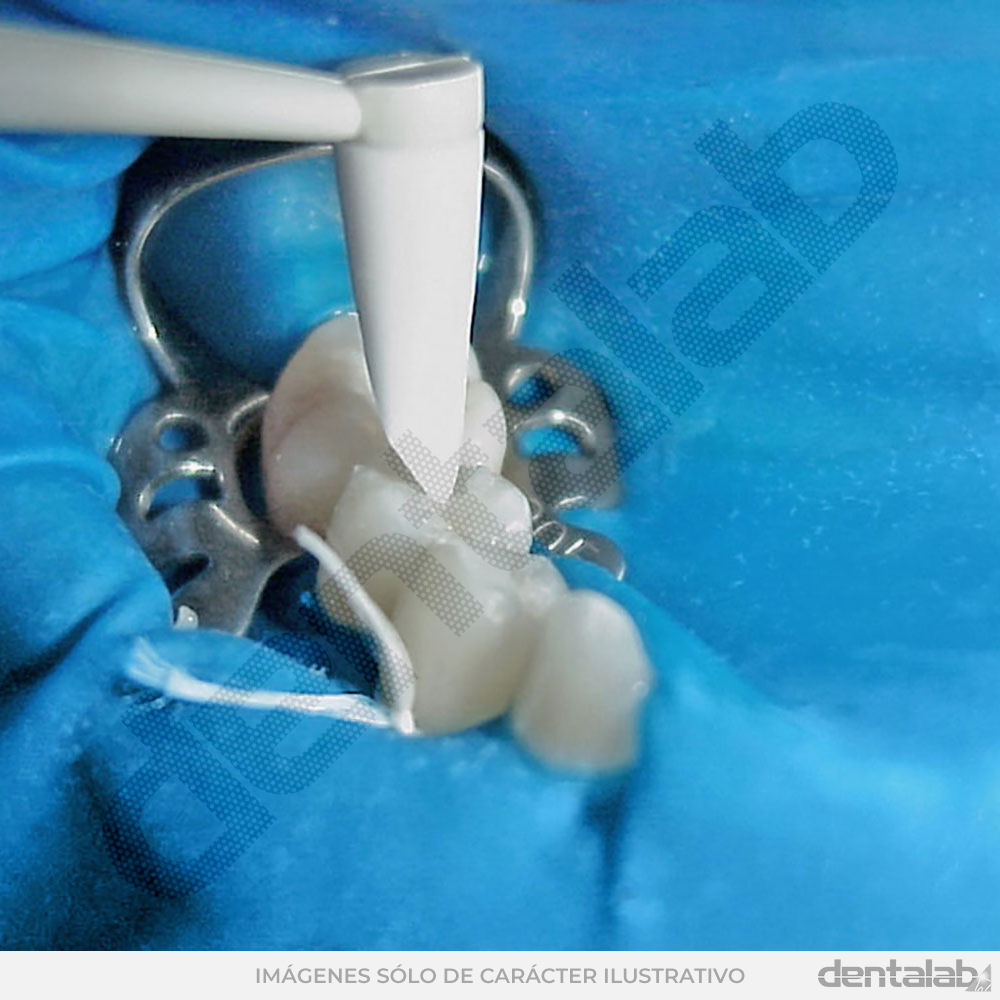 Pinceles de Silicona para Modelar Composites TDV • Esthetic Plus • Kit