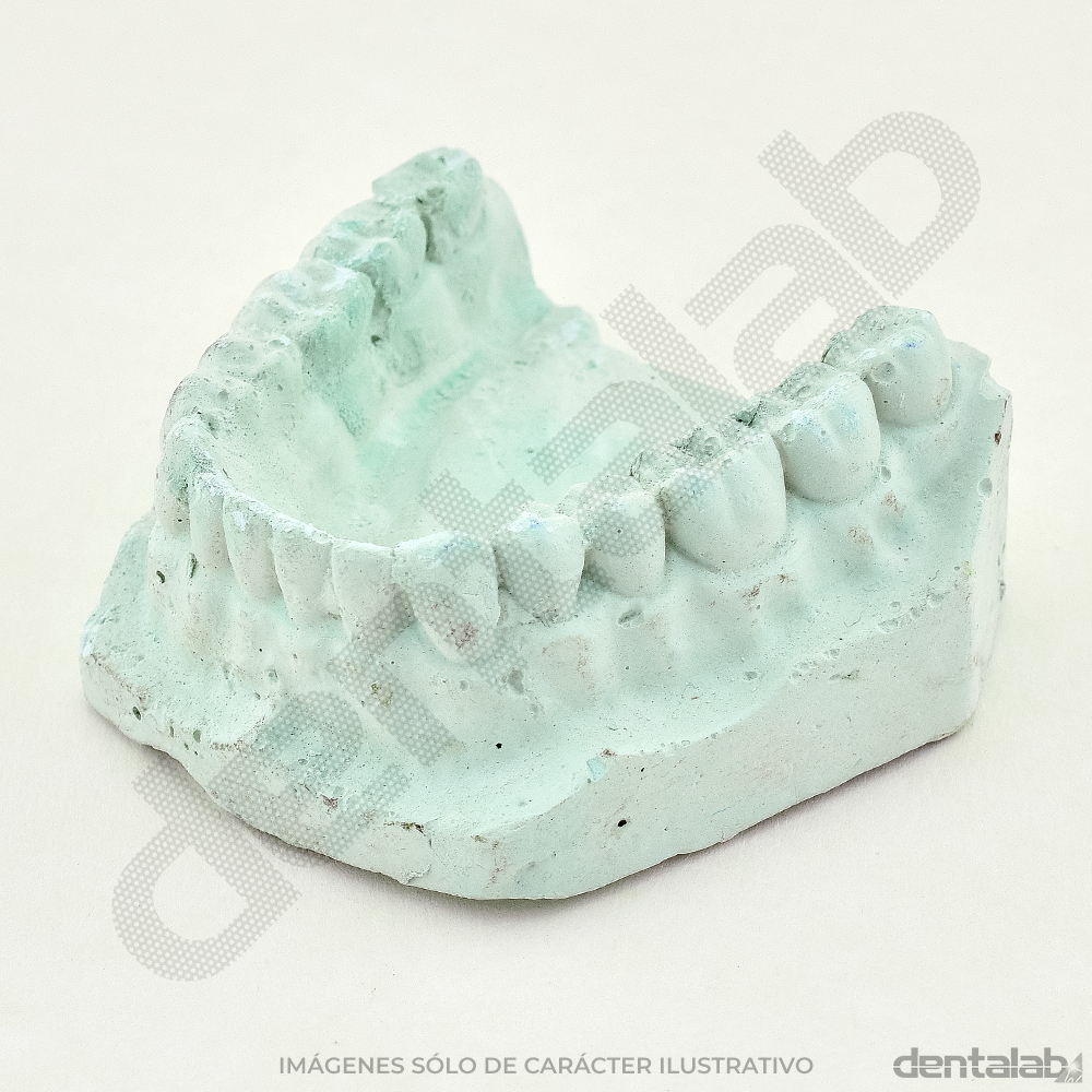 Modelo de Yeso Dentado x Par