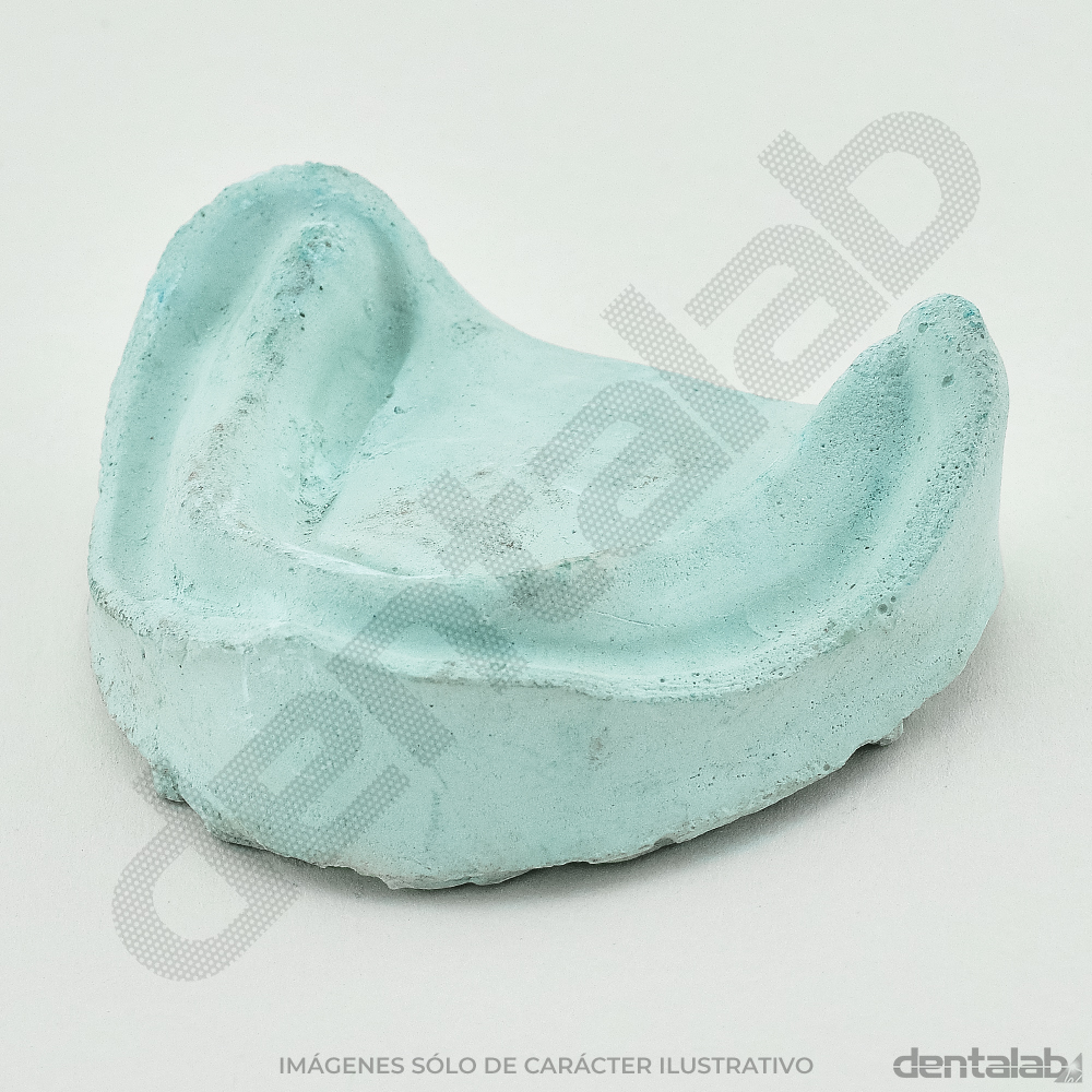 Modelo de Yeso Desdentado x Par